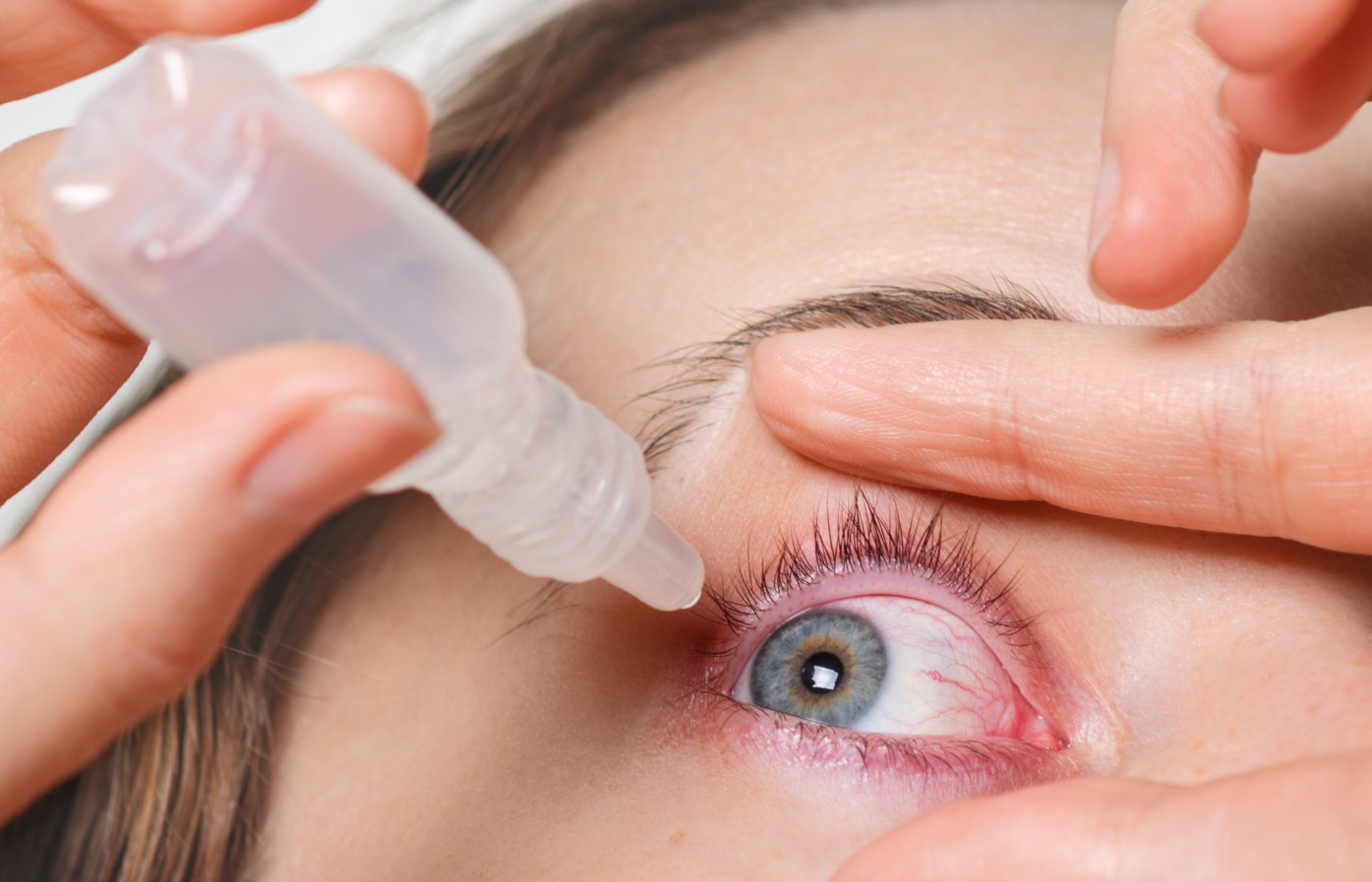 Urgence Ophtalmologiques